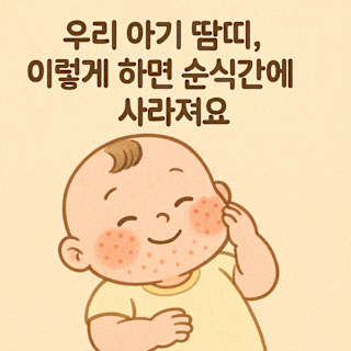 아기 땀띠 썸네일 이미지